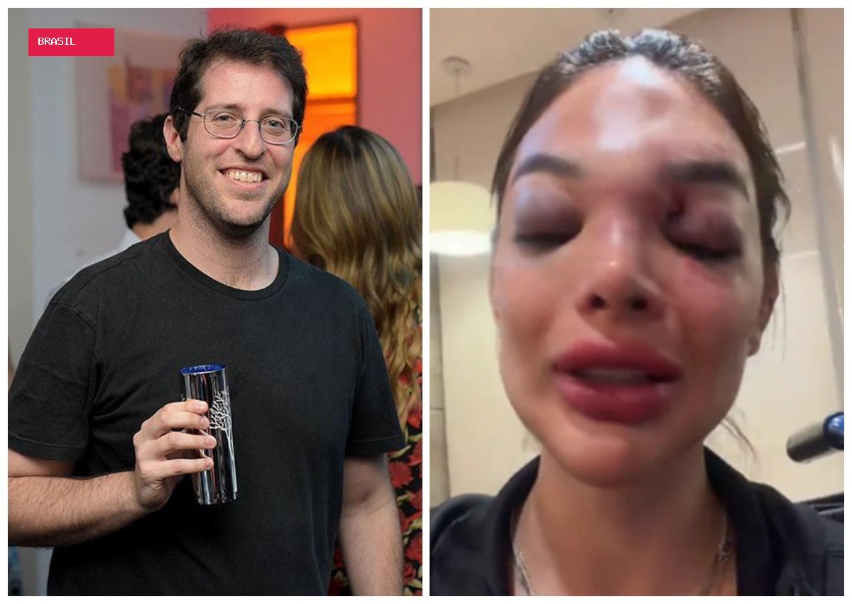 Dentista relata ao 'Fantástico' agressões que sofreu do marido, empresário da Faria Lima
