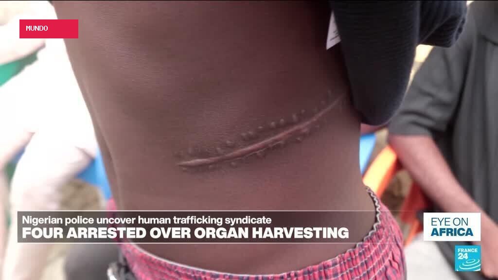 Shady surgeons and Nigeria organ harvesting