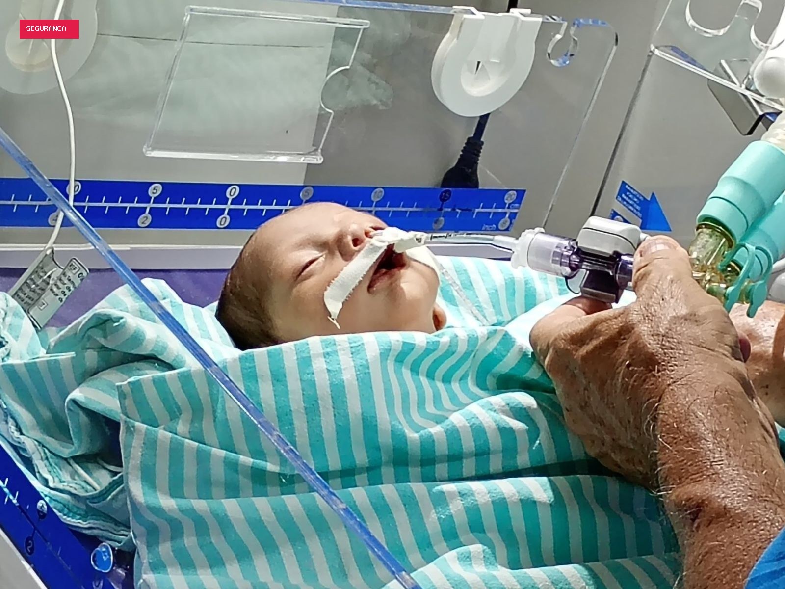 Bebê com malformação no coração tem piora e segue à espera de transferência no Acre