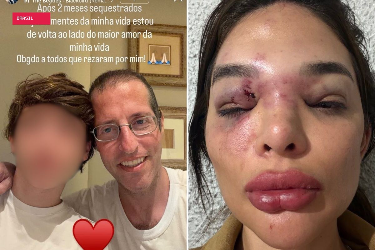 Ivo Kos usou arma de choque e taco de baisebol para agredir esposa, diz MP