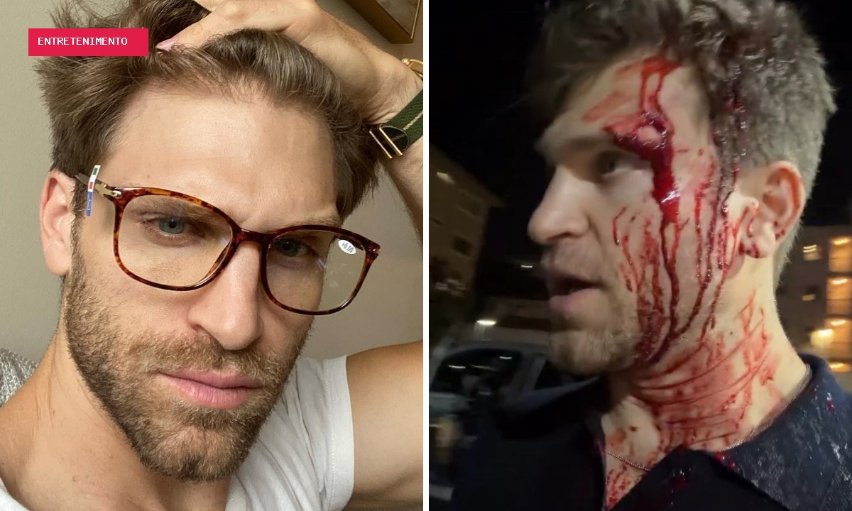 Ator de 'Pretty Little Liars' é agredido durante assalto: 'Ameaçaram me matar por um relógio'