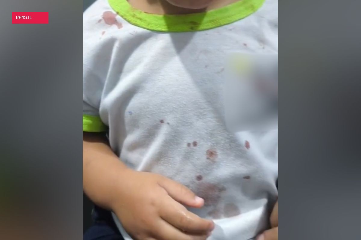 Justiça decide que deve continuar preso padrasto de criança que chegou a CMEI com ferimentos e camisa com